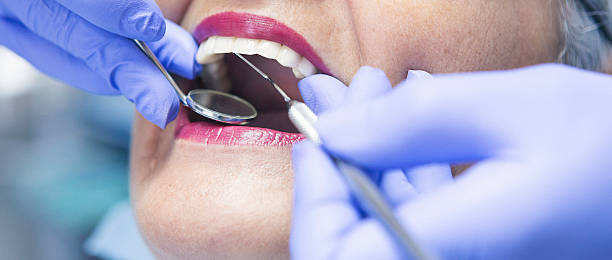 Best Emergency Dentist for Knocked-Out Tooth in Smyrna, TN